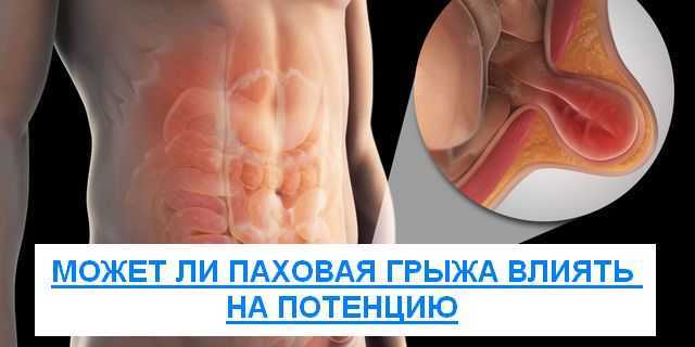 Влияние паховой грыжи на потенцию и эрекцию у мужчин