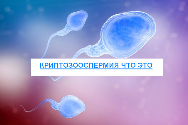 Криптозооспермия у мужчин: причины, симптомы, лечение