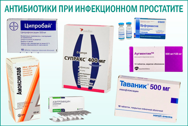 Инфекционный простатит: симптомы и лечение, причины у мужчин