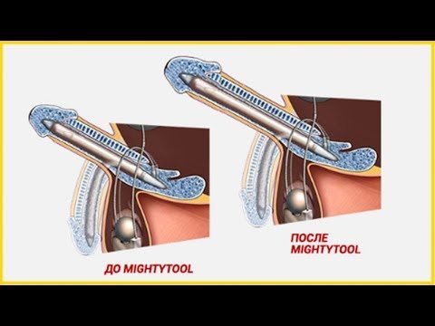 Крем mighty tool: инструкция, цена и где купить, отзывы мужчин