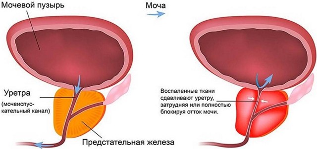 Влияние онанизма на потенцию: польза и вред мастурбации для тестостерона и эрекции у мужчин