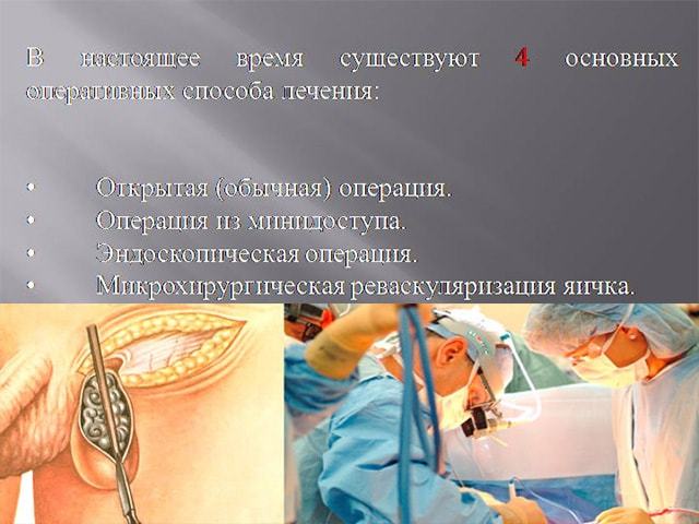 Влияет ли варикоцеле на потенцию мужчины и как?