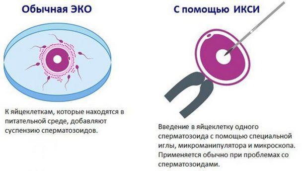 Криптозооспермия у мужчин: причины, симптомы, лечение