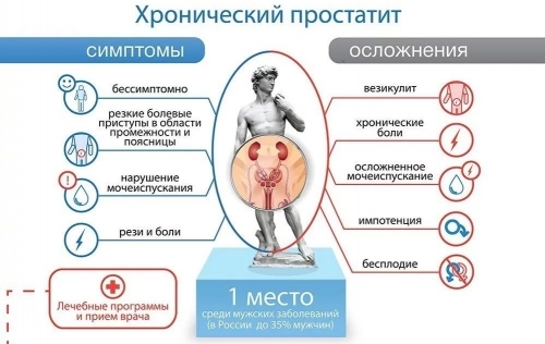 Запущенный простатит у мужчин: причины, симптомы и признаки, лечение