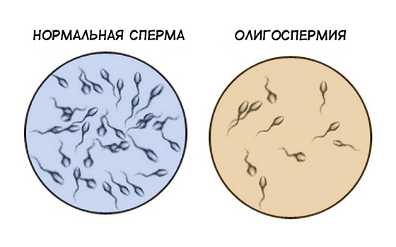 Андродоз: инструкция по применению, цена, отзывы и аналоги