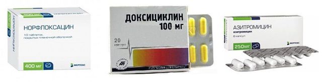 Бактериальный простатит у мужчин: причины, симптомы и лечение