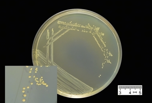 enterococcus faecalis у мужчин: норма, причины, симптомы и лечение