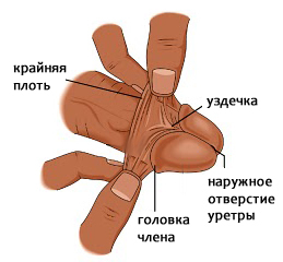 Где находится уздечка у мужчин (фото) на головке, что делать, если короткая и при других проблемах