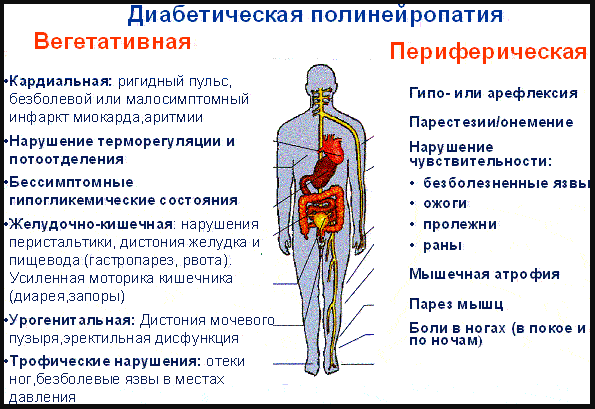 Импотенция при сахарном диабете 2 типа: лечение и профилактика