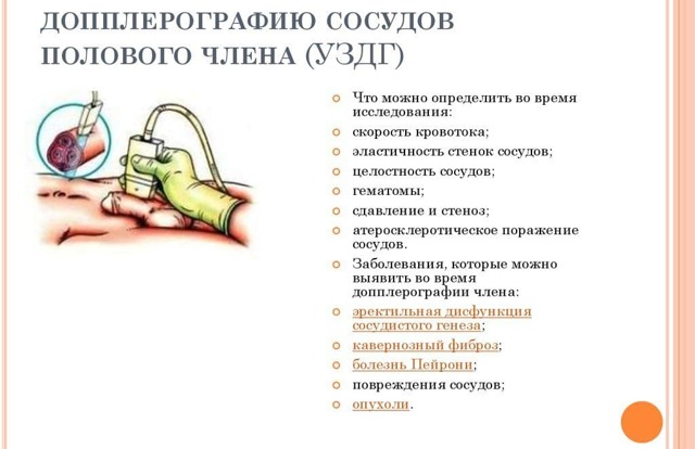 Сосудистая импотенция: лечение (препараты и способы), симптомы