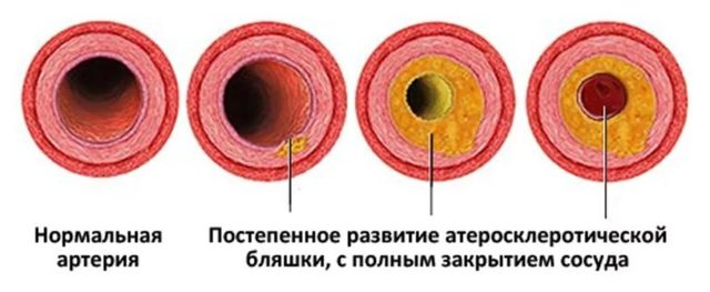 Восстановление потенции народными средствами в домашних условиях у мужчин