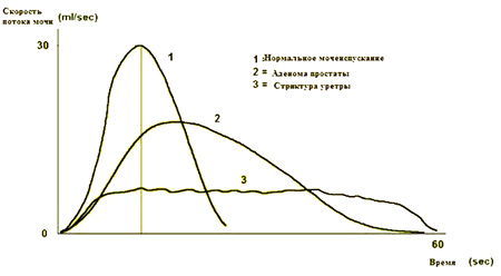 Урофлоуметрия: что это такое, как проводится, подготовка к процедуре, цена
