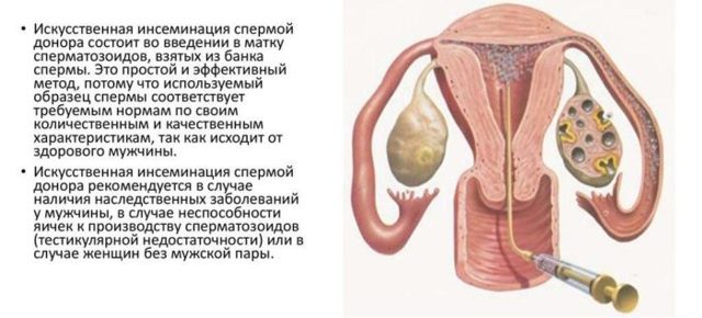 Агрегация сперматозоидов у мужчин в спермограмме: что значит, причины и лечение
