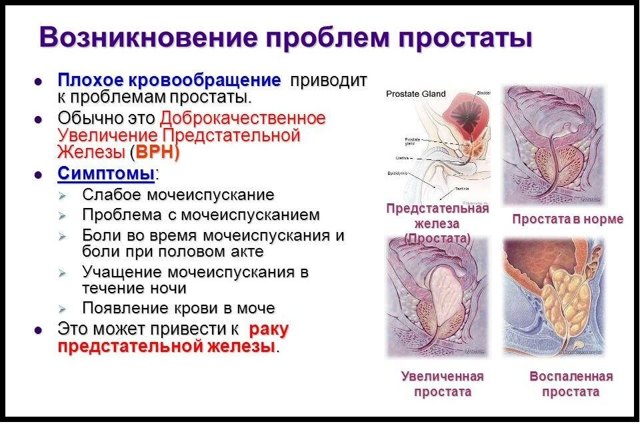 Жжение и зуд при простатите у мужчин: почему и как убрать?