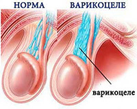 9 болезней яичек у мужчин и детей: описание, симптомы и лечение