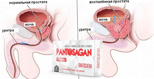 pantosagan (Пантосаган): инструкция, отзывы, цена и где купить препарат