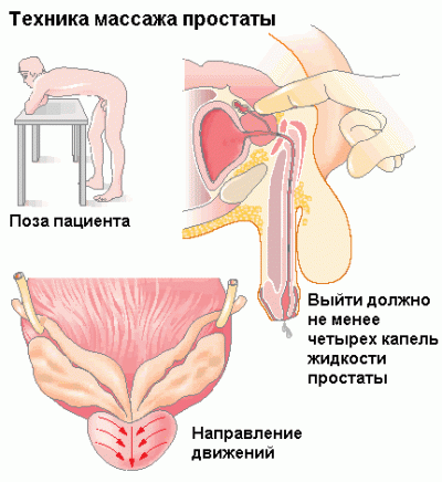 Массаж простаты для повышения потенции и улучшения эрекции