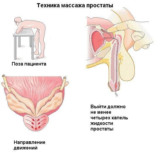 Потеря эрекции во время полового акта: причины, что делать мужчине?