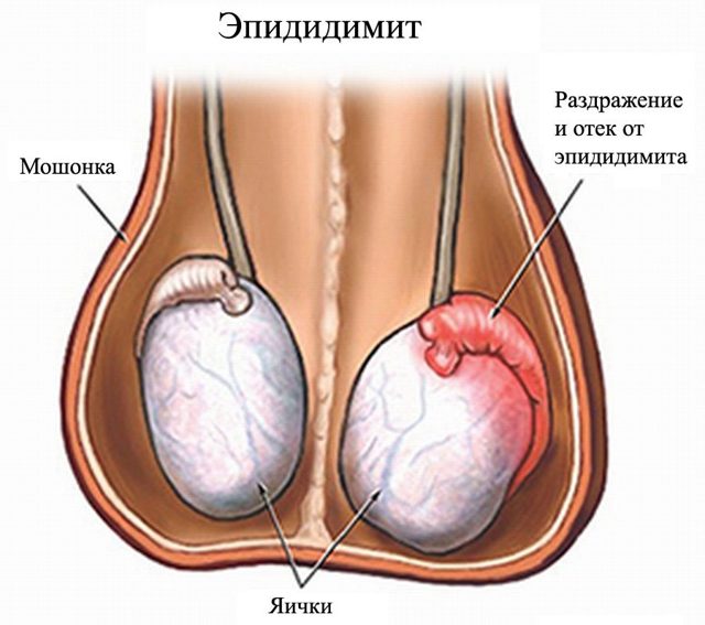 9 болезней яичек у мужчин и детей: описание, симптомы и лечение