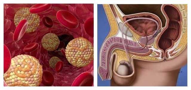 Алкоголь и потенция: как влияет алкоголь на организм мужчины?