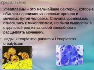 10 советов как 100% улучшить качество спермы у мужчин (+ препараты)