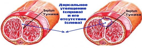 Как удлинить половой член в домашних условиях?