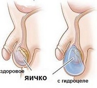 9 болезней яичек у мужчин и детей: описание, симптомы и лечение