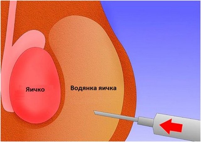 9 болезней яичек у мужчин и детей: описание, симптомы и лечение