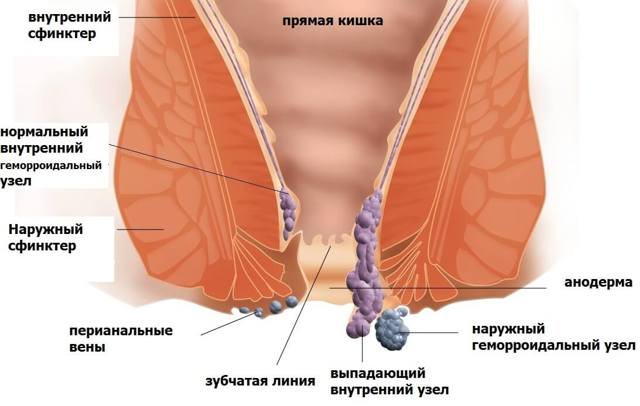 Жжение и зуд при простатите у мужчин: почему и как убрать?