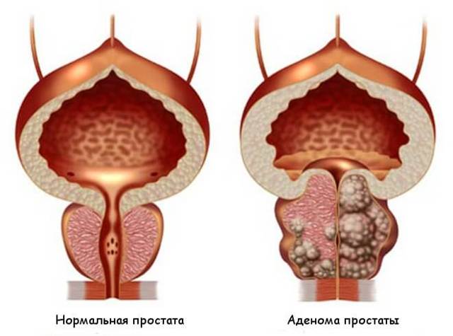 eros spirit (Эрос Спирит) для потенции: отзывы покупателей, инструкция, купить капли