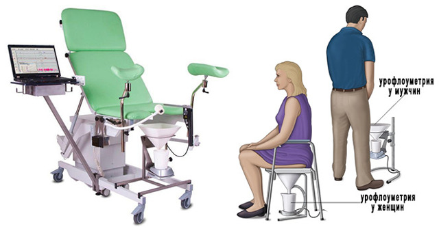 Урофлоуметрия: что это такое, как проводится, подготовка к процедуре, цена