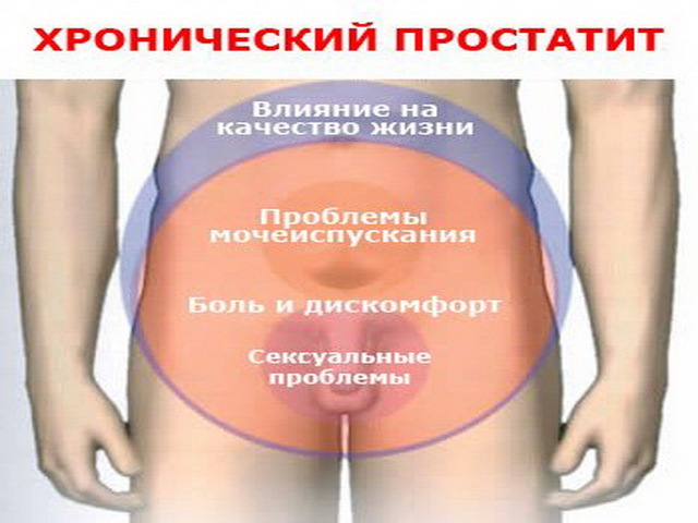 Массаж простаты: как делать самостоятельно и жене мужу, видеоурок