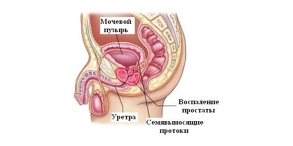 Сперма желтого цвета: почему и что делать мужчине?