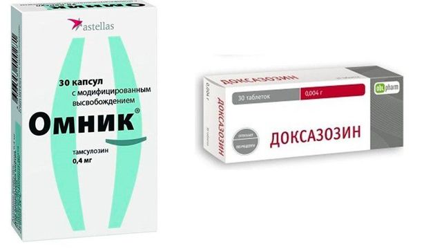Калькулезный хронический простатит (камни в простате): симптомы и лечение, отзывы