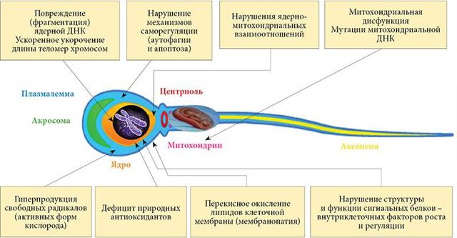 Лейкоцитоспермия у мужчин: причины, симптомы, лечение