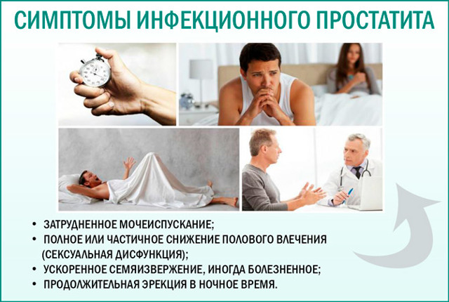 Инфекционный простатит: симптомы и лечение, причины у мужчин