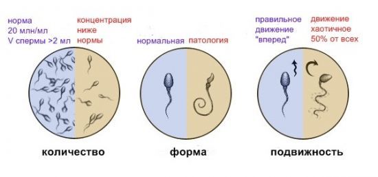 Простатит и зачатие (беременность): влияет ли болезнь на возможность иметь детей?