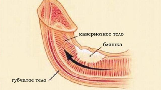 Таксиер: инструкция по применению, цена, отзывы и аналоги