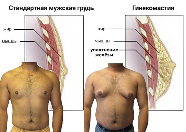 Эстрадиол у мужчин: норма, повышенный и пониженный уровень, причины и лечение
