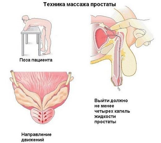Потеря эрекции во время полового акта: причины, что делать мужчине?
