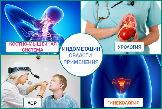Индометацин (свечи и таблетки) при простатите: лечение и отзывы