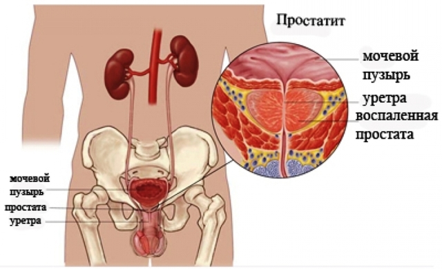 Болит член после секса: почему и что делать мужчине?