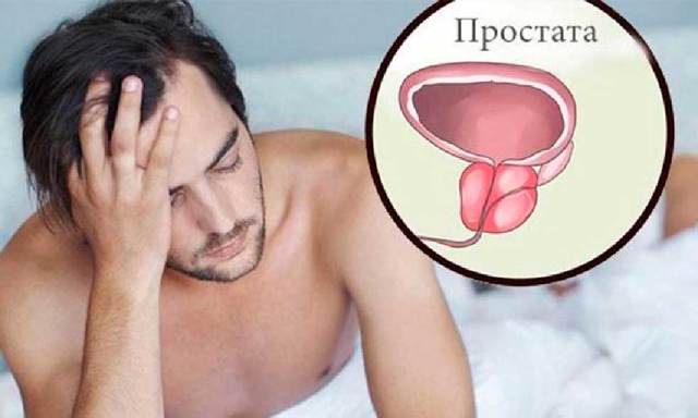 Запущенный простатит у мужчин: причины, симптомы и признаки, лечение