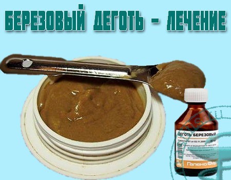 Березовый деготь от простатита: лечение (рецепты и применение), отзывы