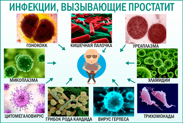 Инфекционный простатит: симптомы и лечение, причины у мужчин