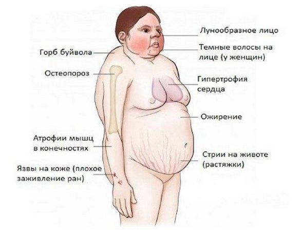 Полная импотенция (последняя стадия) у мужчин: признаки, что делать?