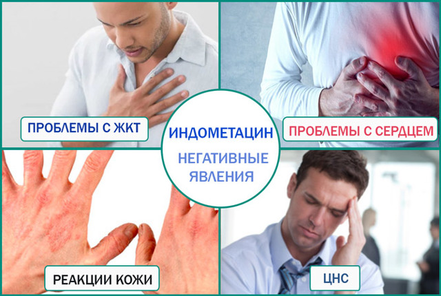 Индометацин (свечи и таблетки) при простатите: лечение и отзывы