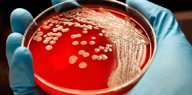enterococcus faecalis у мужчин: норма, причины, симптомы и лечение