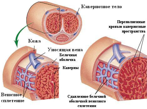 Вакуумная помпа для мужчин: польза и вред, отзывы врачей