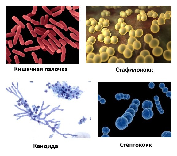 Выделения у мужчин при возбуждении: норма или отклонение?